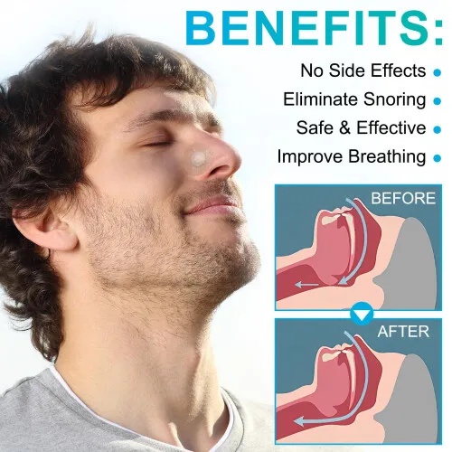 #13 Compare Snoring & Sleep Apnea Aids Before You Buy