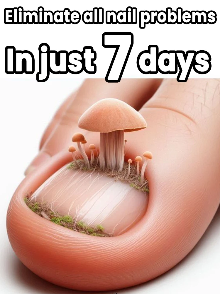 

Solve your nail problems