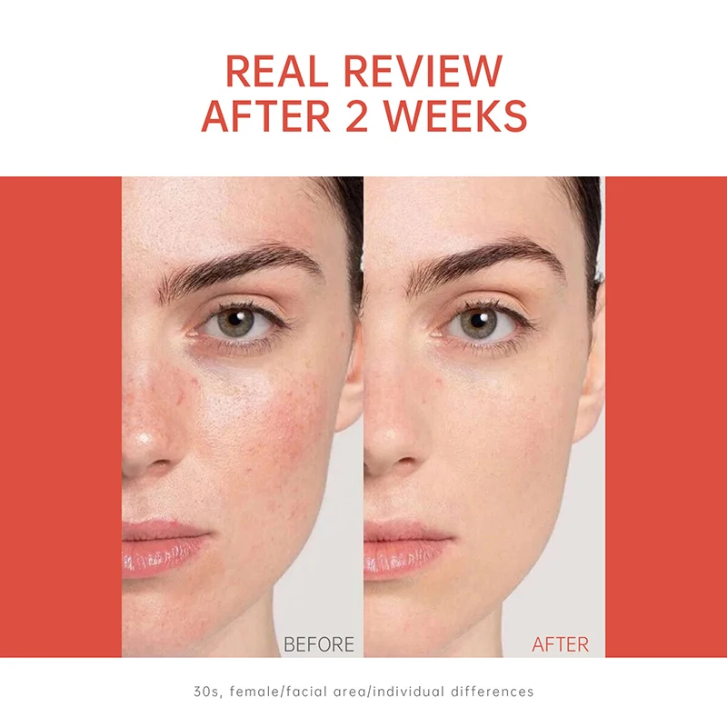 PDRN Salmon DNA Serum Ampoule Advanced Skincare Deep Repair Renew Brighten Tone Strengthen Barrier Firming Face Essence Korean