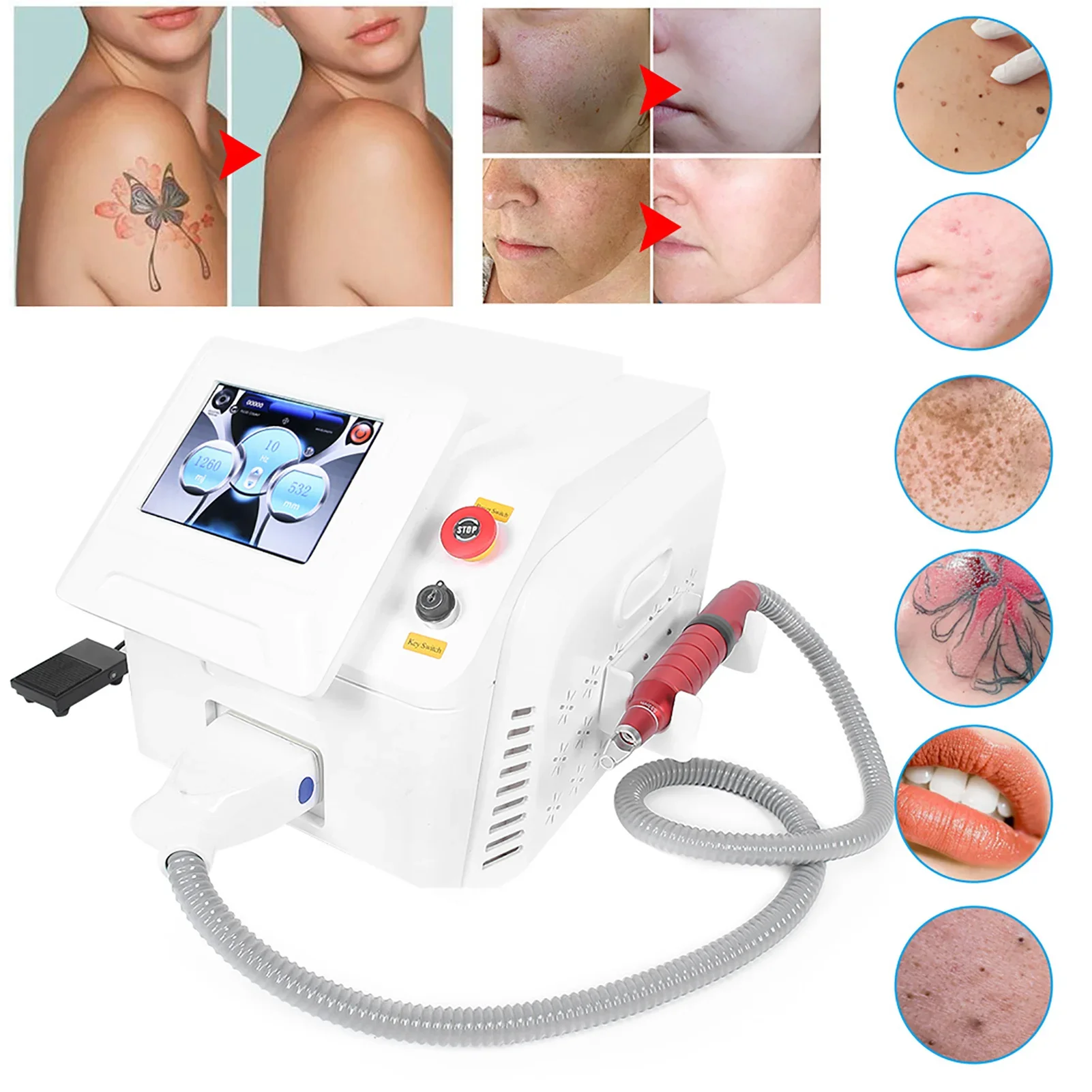 

Picosecond Laser Beauty Machine Tattoo Eyebrow Removal Tattoo Removal Beauty Machine Skin Whitening Spot Removal Instrument 500W