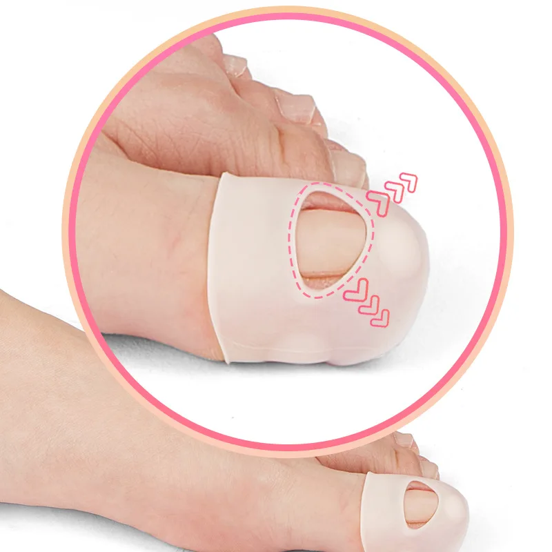 Correcteur d'ongles incarnés, outil de redressage des ongles des orteils réutilisable pour soulager la douleur, traitement fongique, soin Paronychia, outil de pédicure