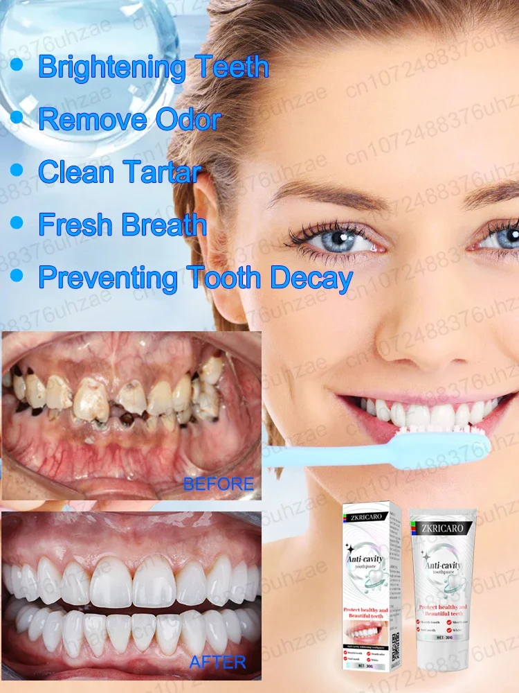 Repair cavities, Prevent tooth decay,remove plaque, toothache, whiten teeth, relieve periodontitis, freshen up bad breath