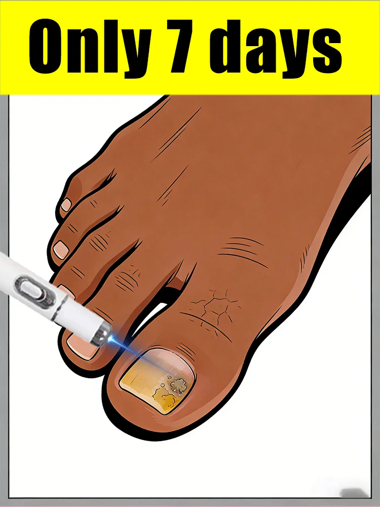 اختراق سريع، يصبح نيميلز شفافة وخالية من الفطريات.