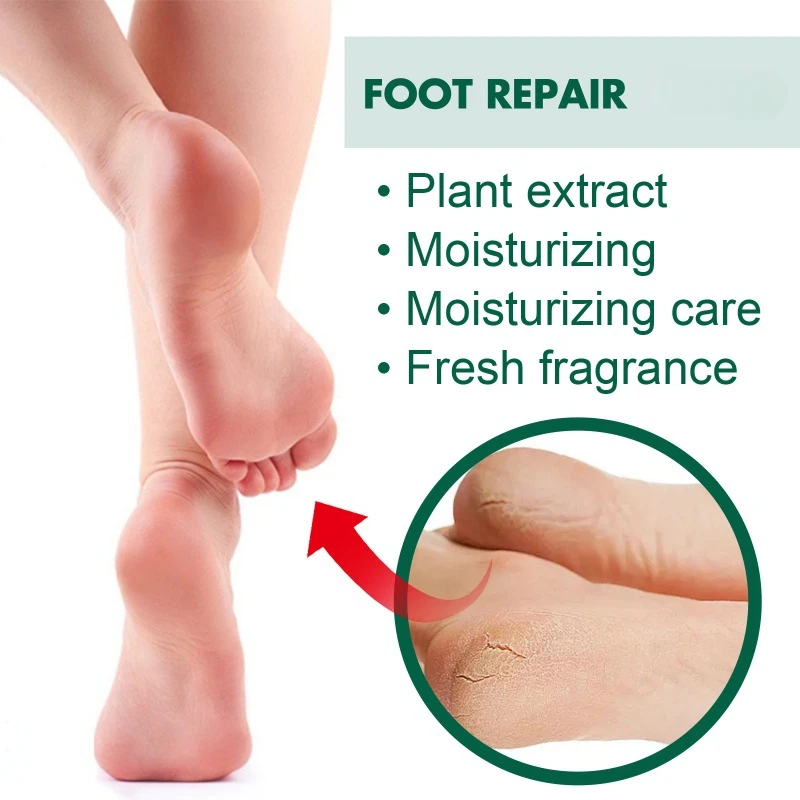 Anti Cracked Heel Treatment Cream relieve Dry itchy peeling Removal Callus Dead Skin Balm Foot Mositurizing Repair Skin Care