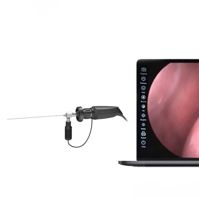 Automatic  Medical Ent Mirror Endoscope Camera USB Portable Endoscope System