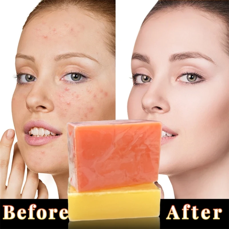 Y1UF 3x Kojic Acid Xà phòng làm sáng da Làm sáng da Xà phòng Kojic Acid Dưỡng ẩm