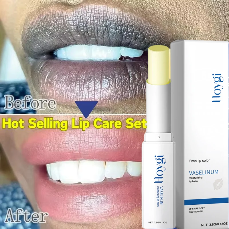 

Instantly Lip Balm Remove Dark Lighten Melanin Lip Mask Fade Lip Line Brighten Exfoliating Moisturize Dead Skin Repair Lip Care