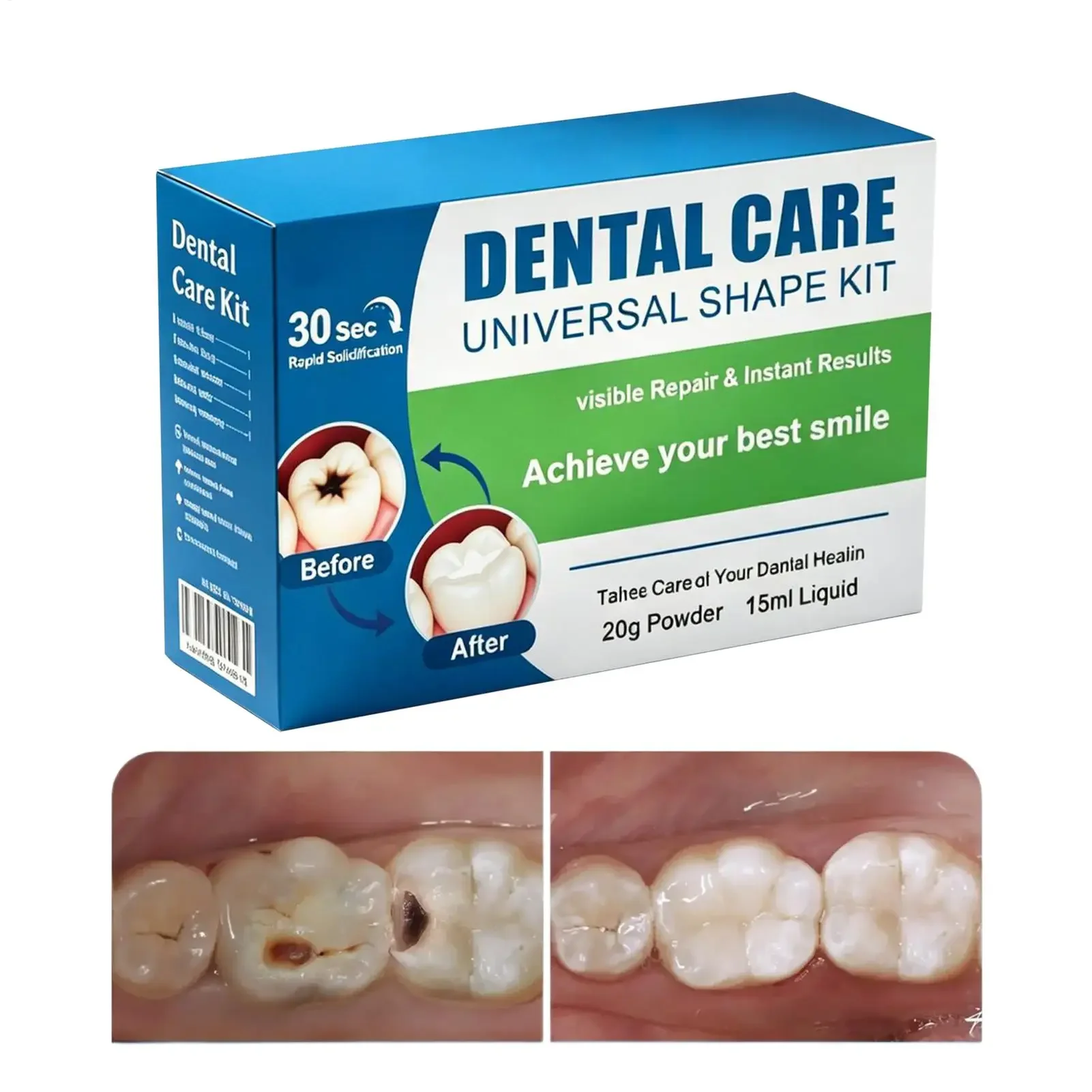 Temporary Tooth Repair Kit Gentle Quick Relief Portable Instant Tooth Repair Kit For Home Travel Work Meeting Job Wedding Party