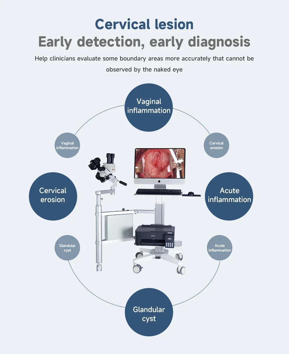 رائجة البيع عالية بكسل نطاق كولبو البصري لايكا عدسة بصرية ZY-9900C لفحص المهبل