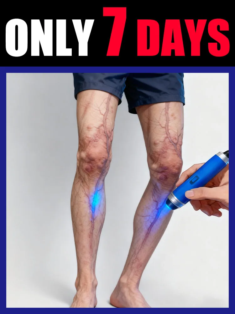 Vendita calda di seconda generazione del 2025: dici addio ai tuoi problemi in 7 giorni