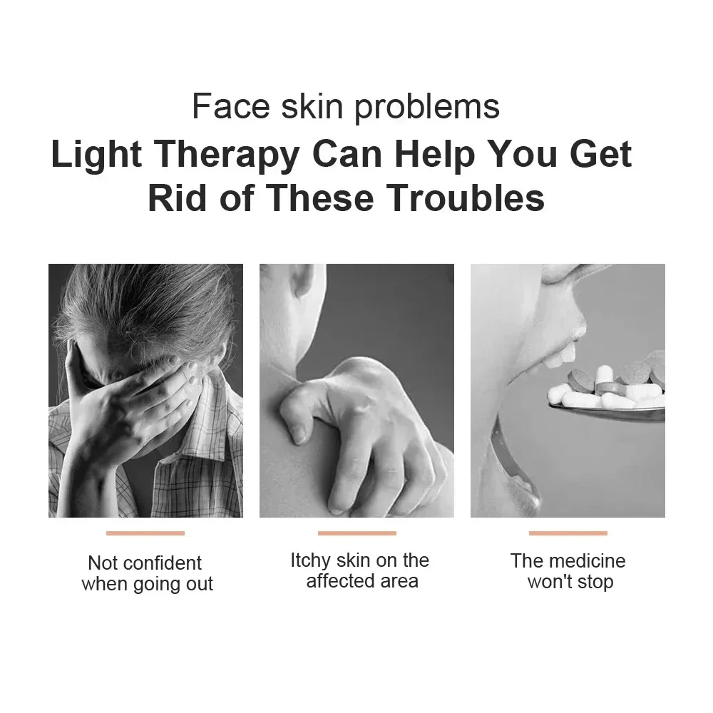 Thumbnail 2 - #49 Best Acne Treatments & Kits to Buy In 2026