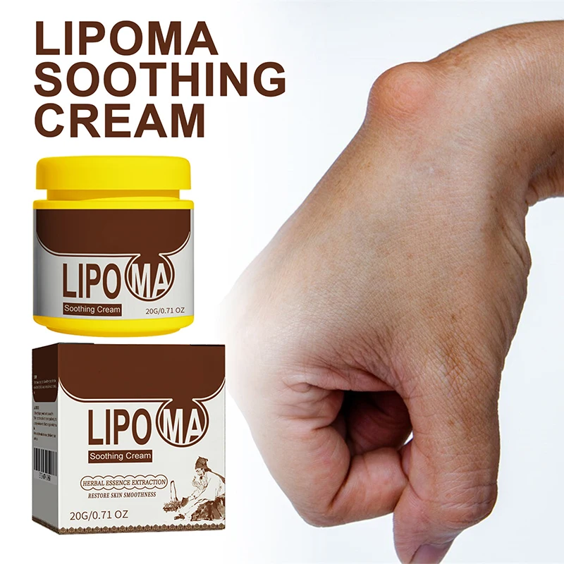 Anti-Zwelling Lipoma Verwijderingscrème 20G Organische Lymfedrainage Detox Effectieve Pijnloze Behandeling Borst Lymfeklieren Crème