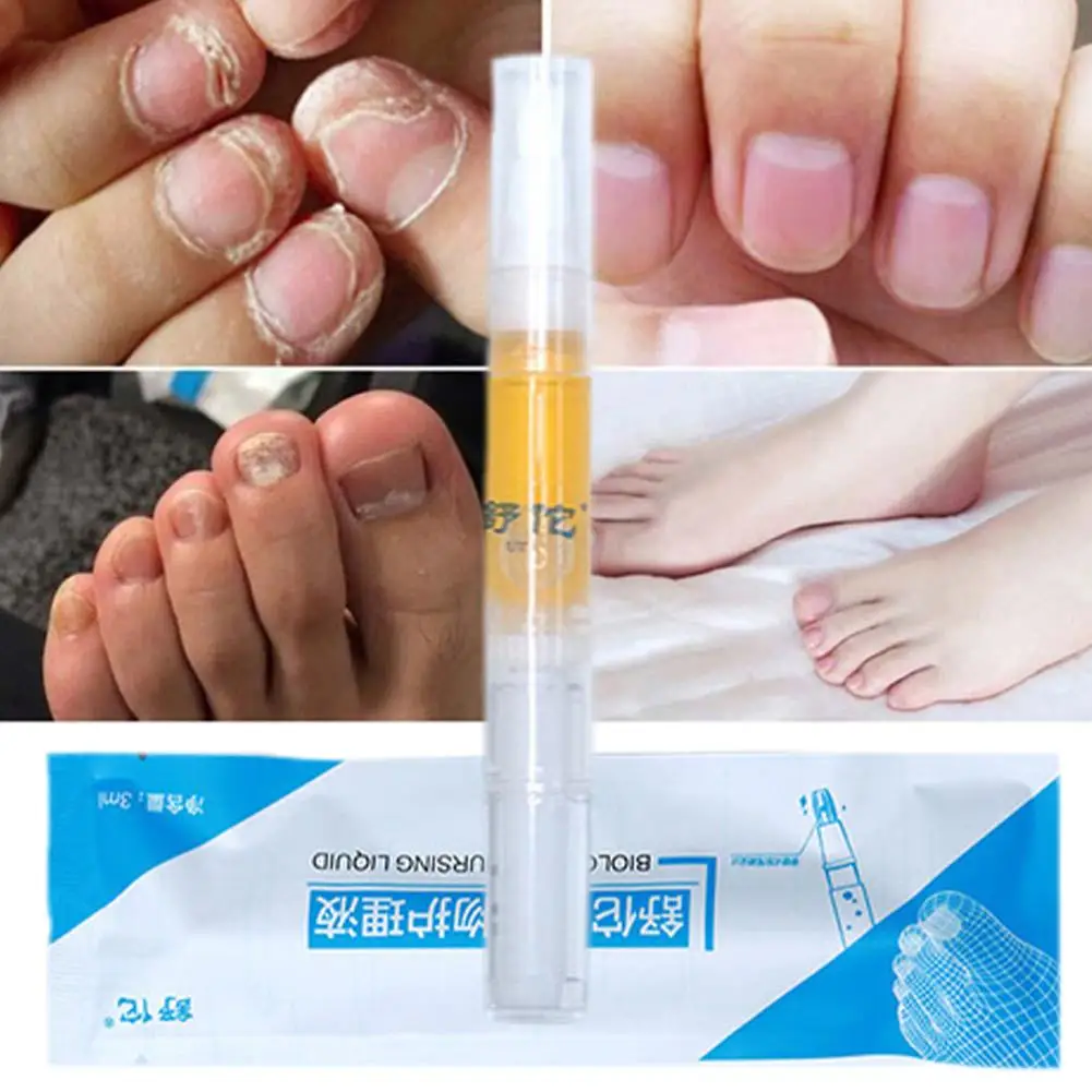 High-end Nail Care Pen Toenail Repair Pen With Natural Ingredients Nail Beauty Health Nail Repair Essence Gentle Care Tool