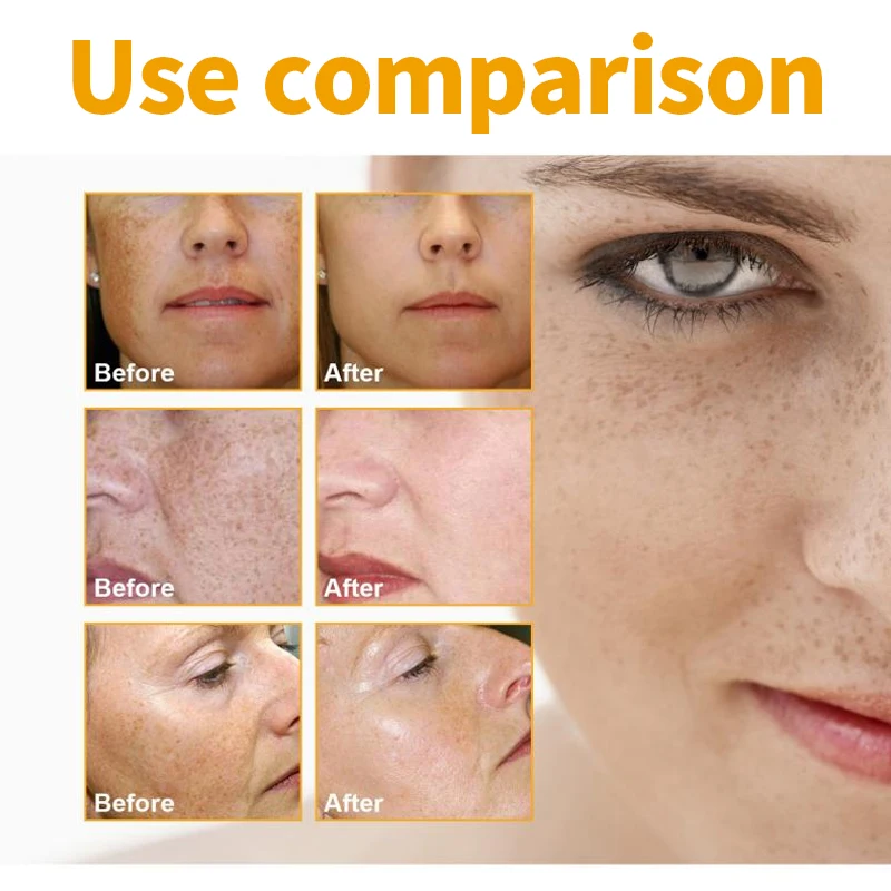 All Natural Turmeric Face Cream - Skin Brightening Lotion for Face & Body Cleansing Acne Fighting Scar Reducing Body Lotion
