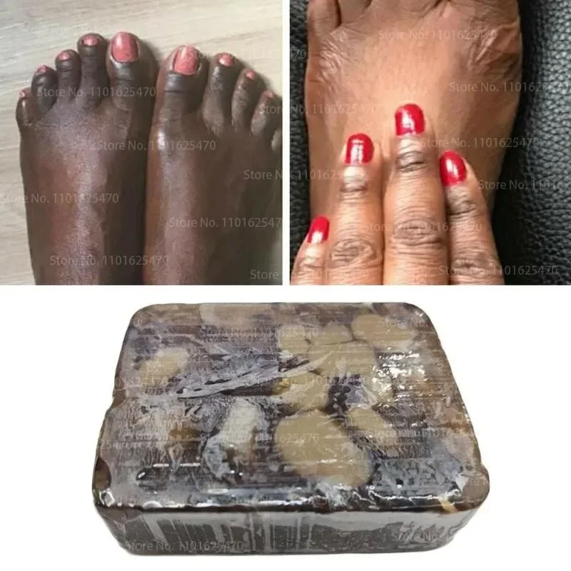Afrika Siyah Sabun Melanin Kaldırmak için Anti-aging Güzellik Nemlendirici Doğal Banyo Vücut Tedavisi Akne Beyazlatma Cilt Bakımı