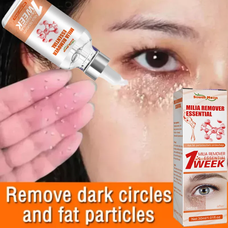 Fat Granules Removal Eye Serum Eye Milia Repair Treatment Products Wrinkle Lifting Moisturizing Anti-Puffiness Korean Skin Care