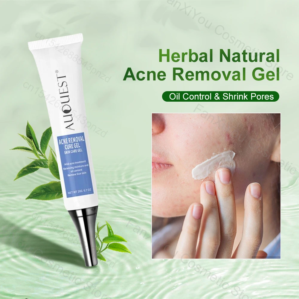 Herbal Acne Face Cream Pimple Scar Remover Gel Oil Control Shrink Pore Pockmark Smooth Acne Marks Facial Cream Skin Care Product