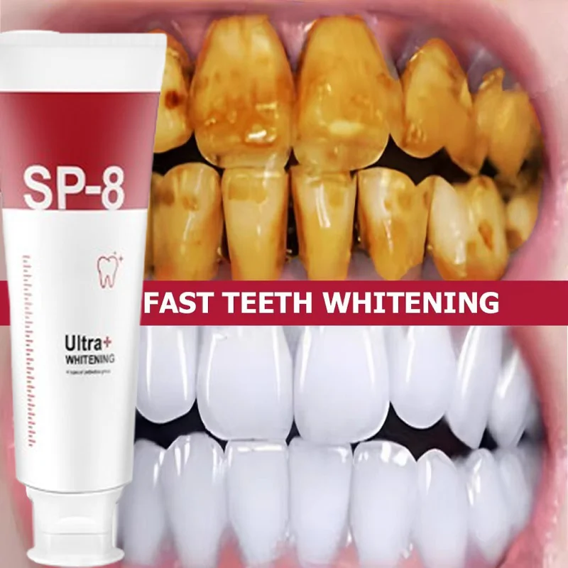 Pasta de dientes probiótica SP-8, blanquea los dientes, elimina el aliento fresco, limpieza de la boca, previene la periodontitis, espuma suave, productos para el cuidado de los dientes bucales