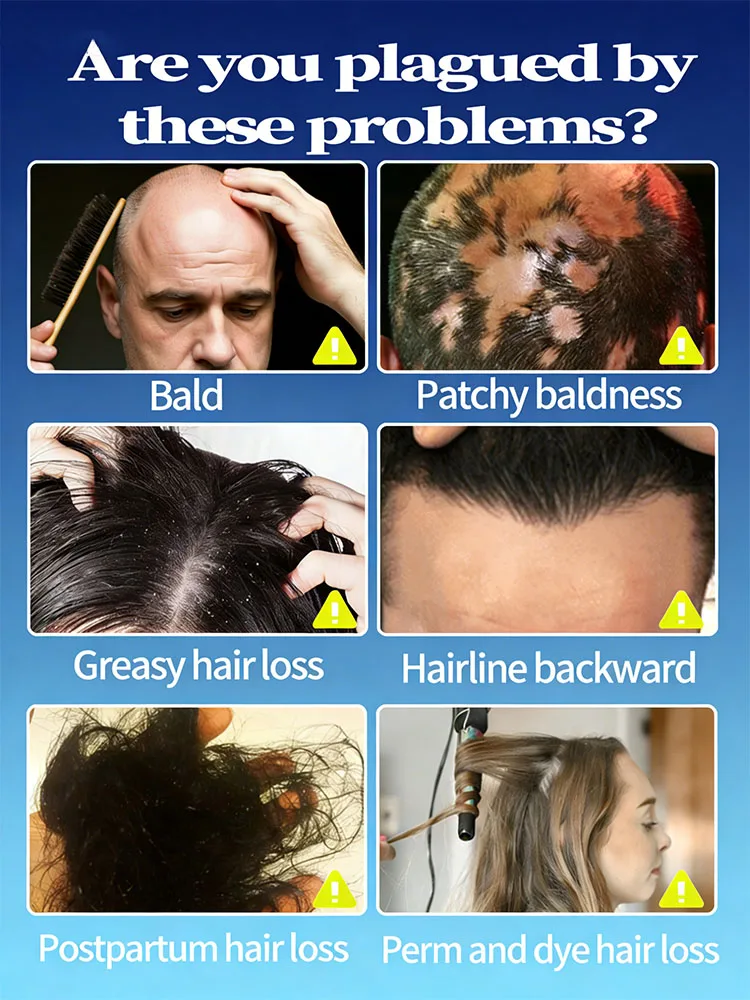 Nourishes the scalp without stress fostering ʜᴇᴀʟᴛʜʏ ᴄᴏɴsɪsᴛᴇɴᴛ ʜᴀɪʀ ɢʀᴏᴡᴛʜ ɴᴀᴛᴜʀᴀʟʟʏ #2