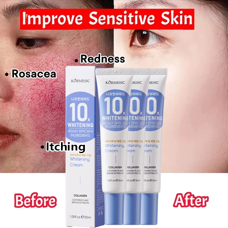 Repair Facial Redness Cream Instant Spider Vein Remove Sensitive Skin Sooth Anti Redness Rosacea Treat Lotion Korean Cosmetics