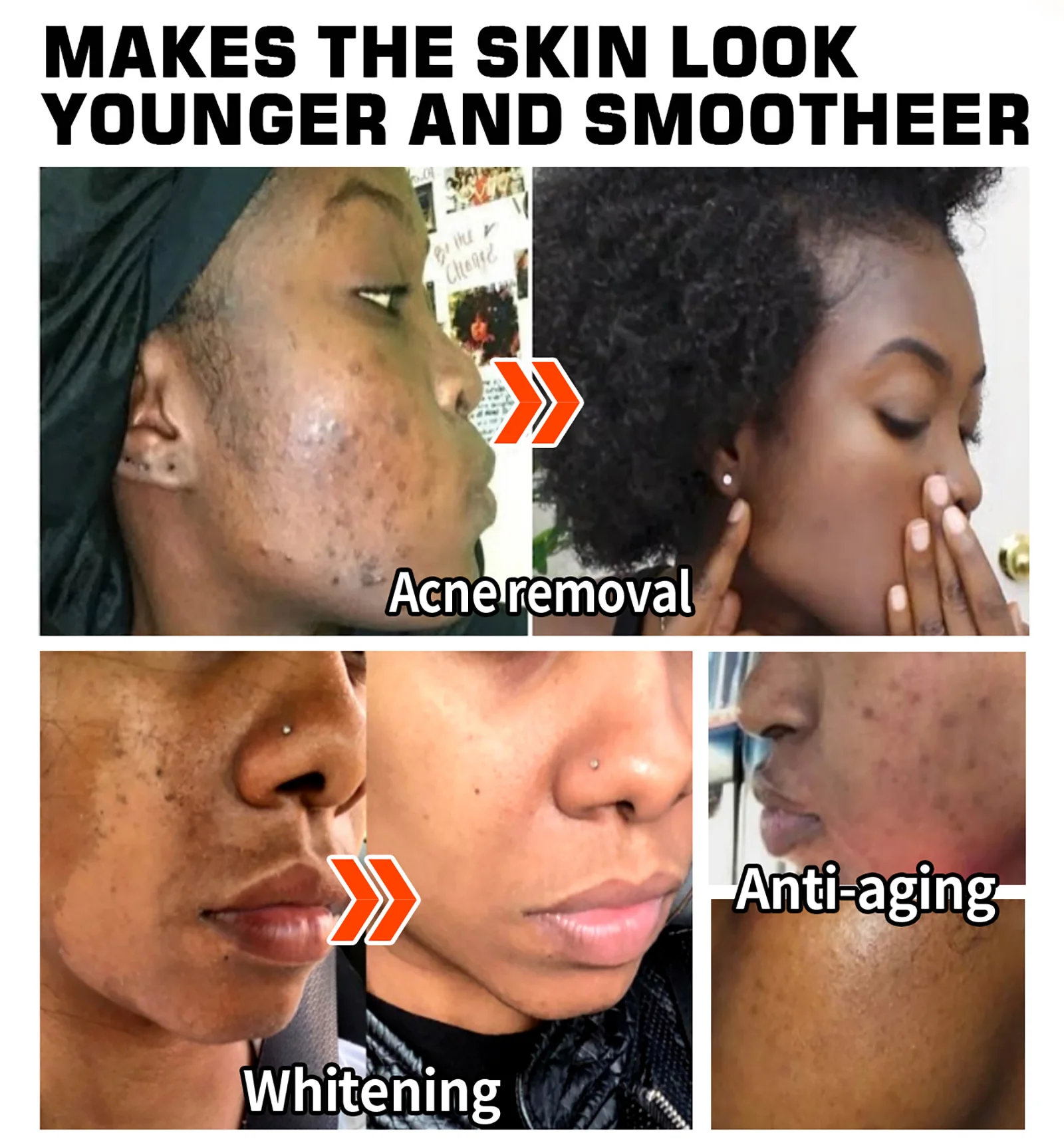 LKIAE Vitamins C, Vitamins A Whitening Face Cream, Reduce Dark Spots, Clean Skin, Day and Night Facial Cream For All Skin Types