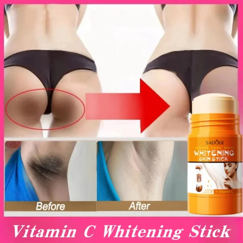 Whitening Cream Private Parts Underarm Bleaching Serum Whiten Butt Knee Brighten Inner Thigh Intimate Parts Dark Remove Melanin