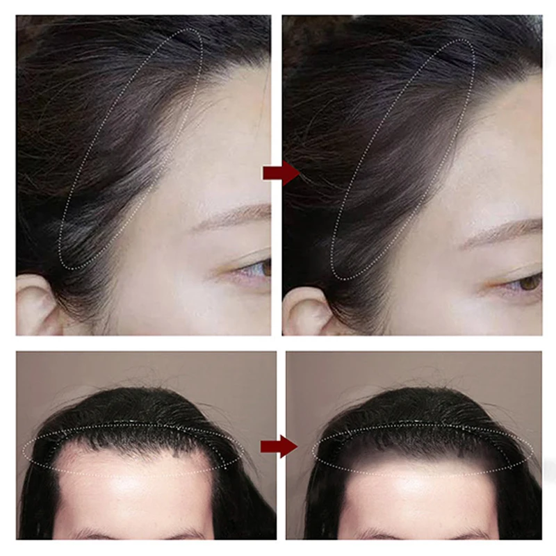 Hairline Repair Filling Powder with Puff Fluffy Thin Powder Pang Line Shadow Powder Forehead Hair Natural Makeup Concealer