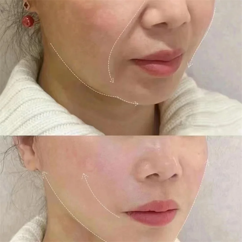 Masseur corporel Portable pour Lifting du visage, radiofréquence, microcourant, doigt doré, Rf Ems, Machine de beauté, doigt en diamant