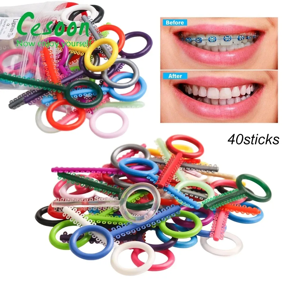 1040Pcs/40Sticks Dental Orthodontic Elastic Ligature Ties Colorful Rubber Bands for Brackets Braces Dentistry Treatment Material