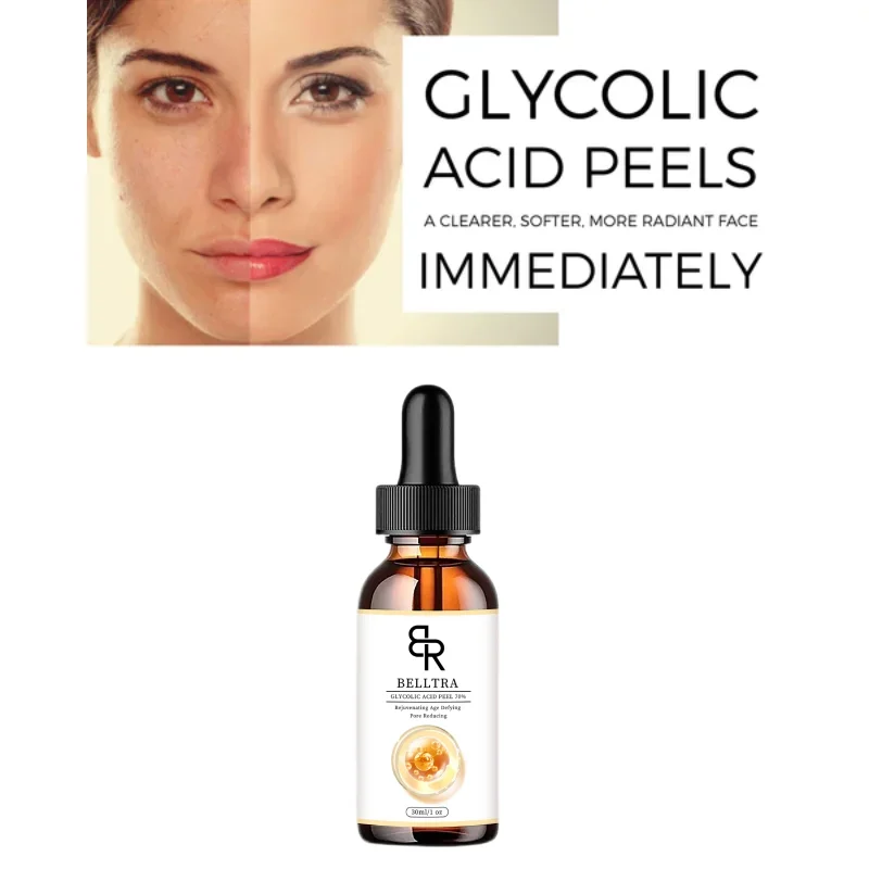 

70% Glycolic Acid Chemical Peel Anti-Aging Brightening Smoothing Fine Lines Skin Pigmentation Acne Scars 30ml