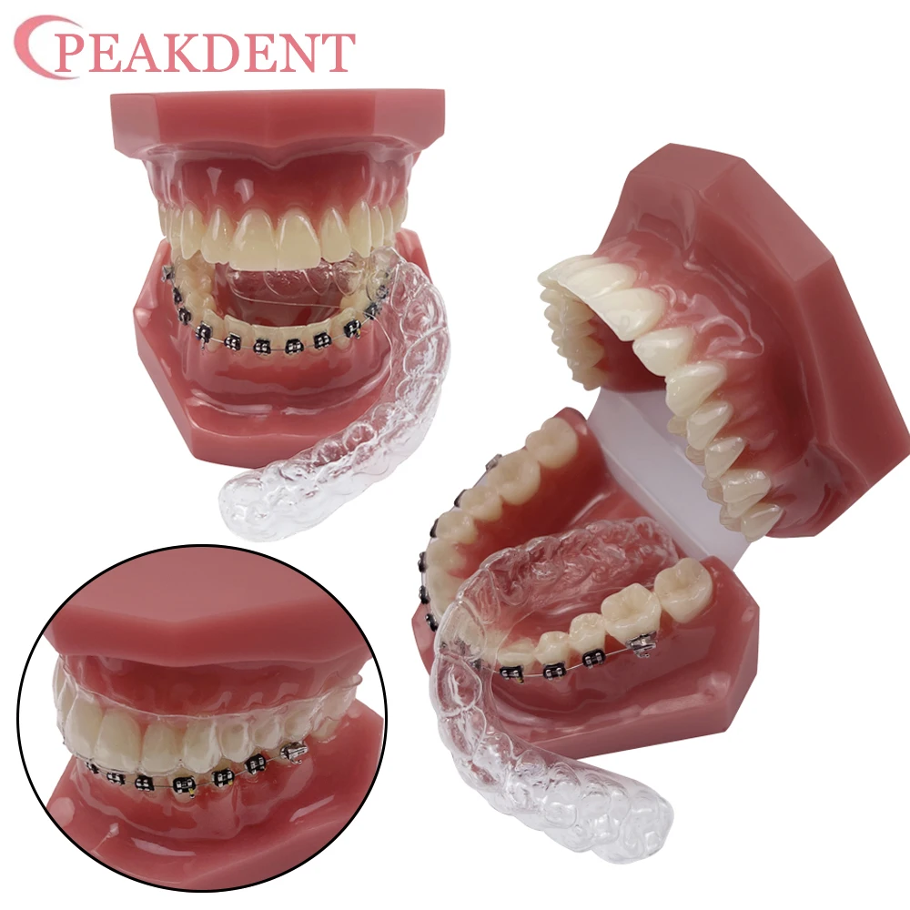 

Стоматологическая ортодонтическая модель с фиксатором, невидимый кронштейн, брекеты Typodont, брекеты для зубов для изучения обучающей демонстрации