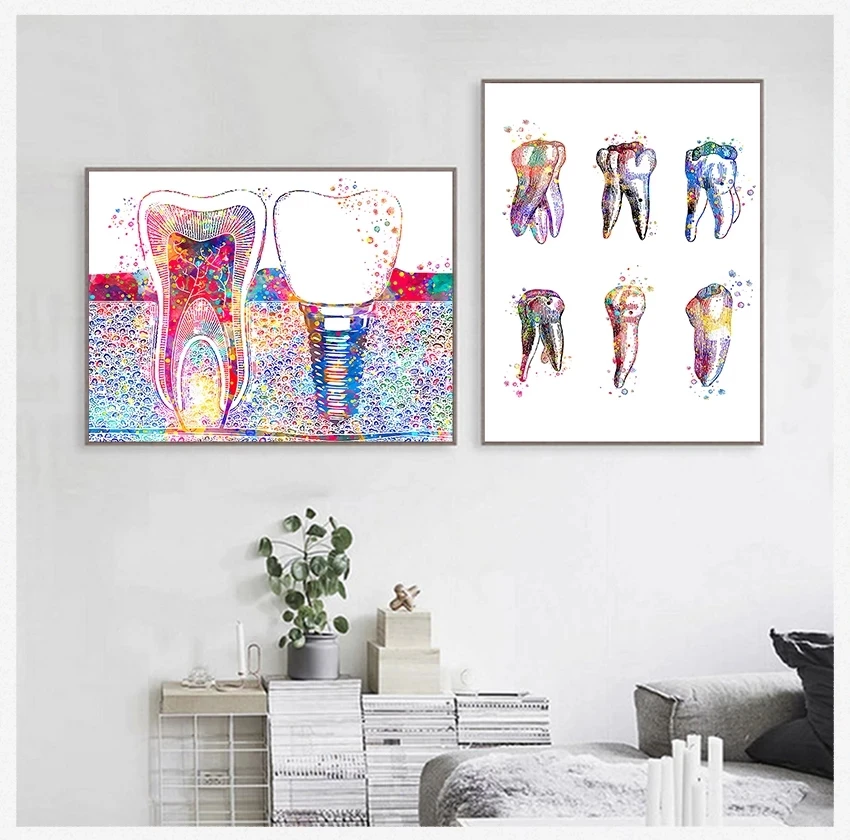 Tooth Implant Dentist Anatomy Prints Canvas Wall Painting Dental Art Poster Medical Wall Art Pictures Hospital Clinic Decoration