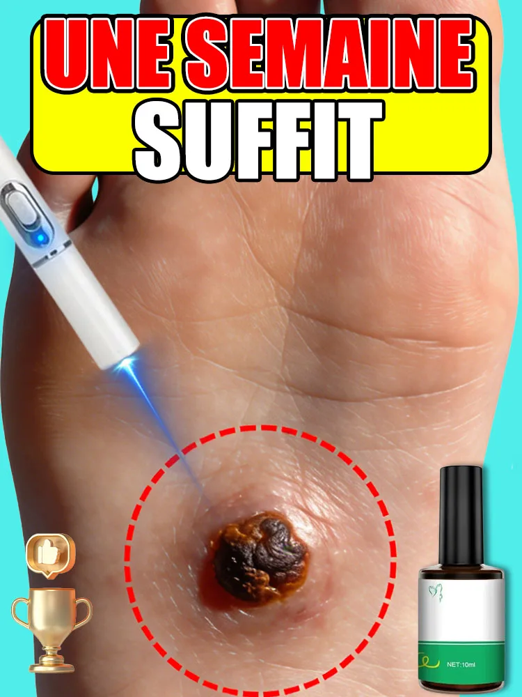 

Новейшая и популярная отшелушивающая лазерная ручка, простая в использовании в повседневной жизни.