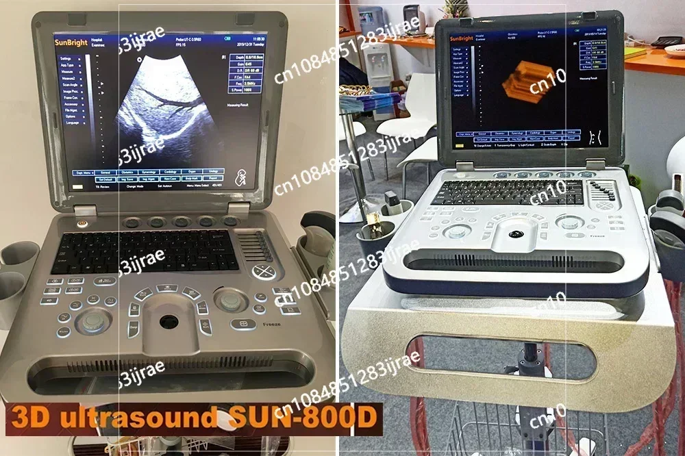 Portable 3d Ultrasound Machine Medical Scan Digital Pseudo Color Usg 4d Optional Ecography