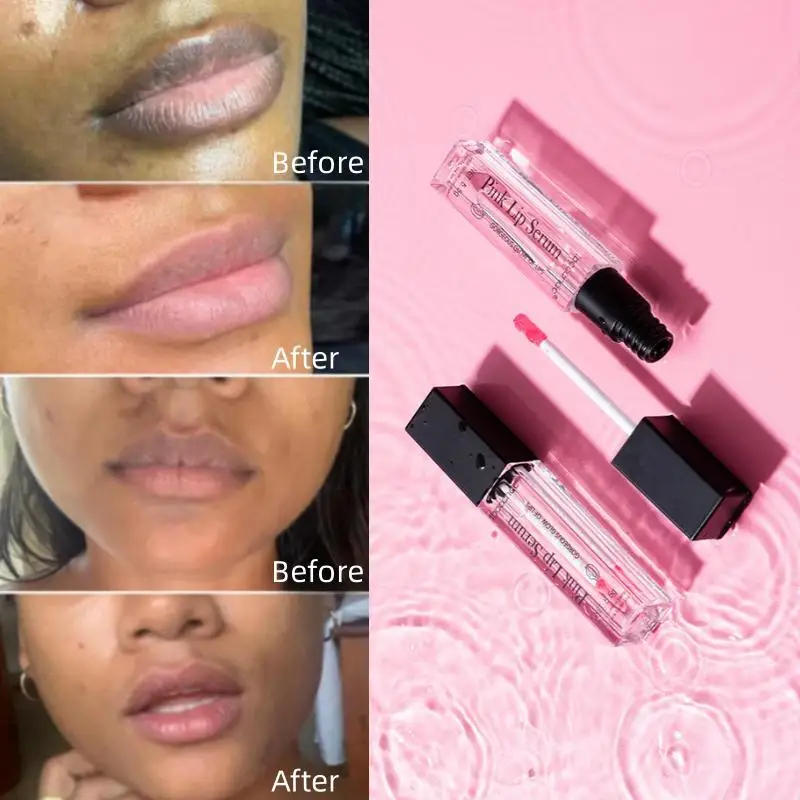 Potent Remove Darkening Lips Gloss Oil Permanently Moisturizing Exfoliating Whitening Lip Sexy Lip Moisturizing Care Cosmetics