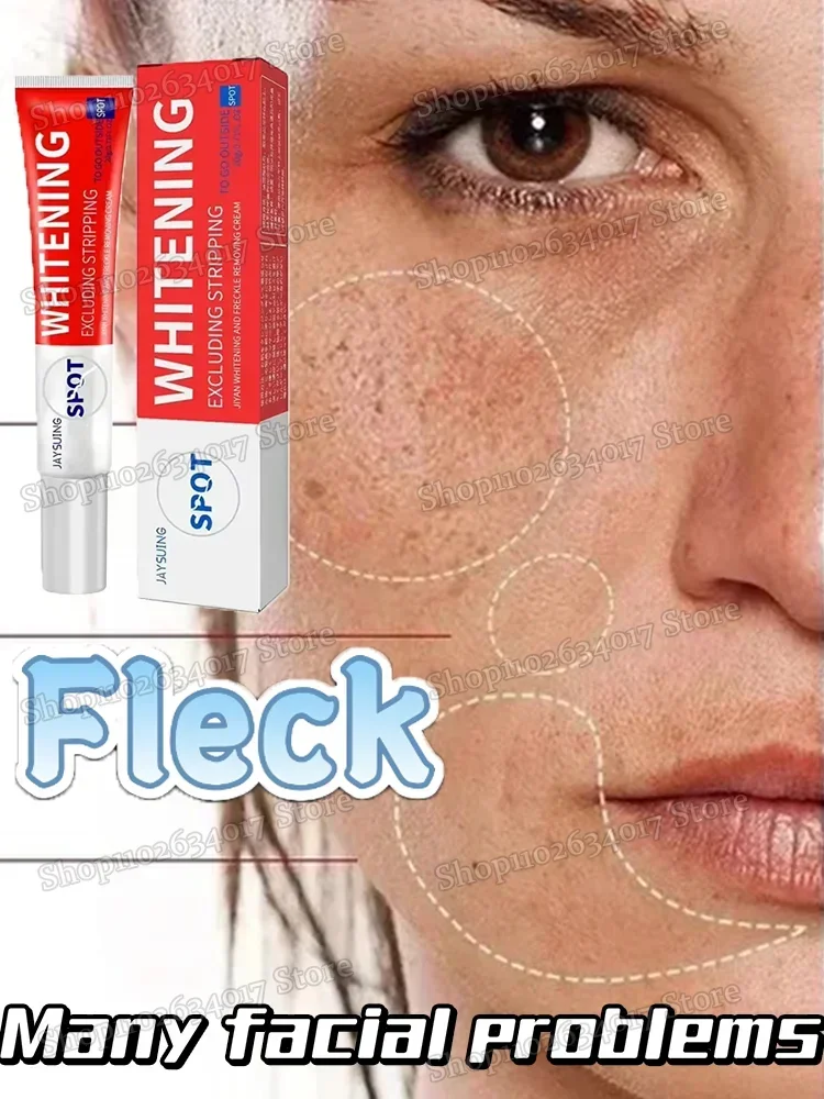 

Pigment scar mole freckle removal cream