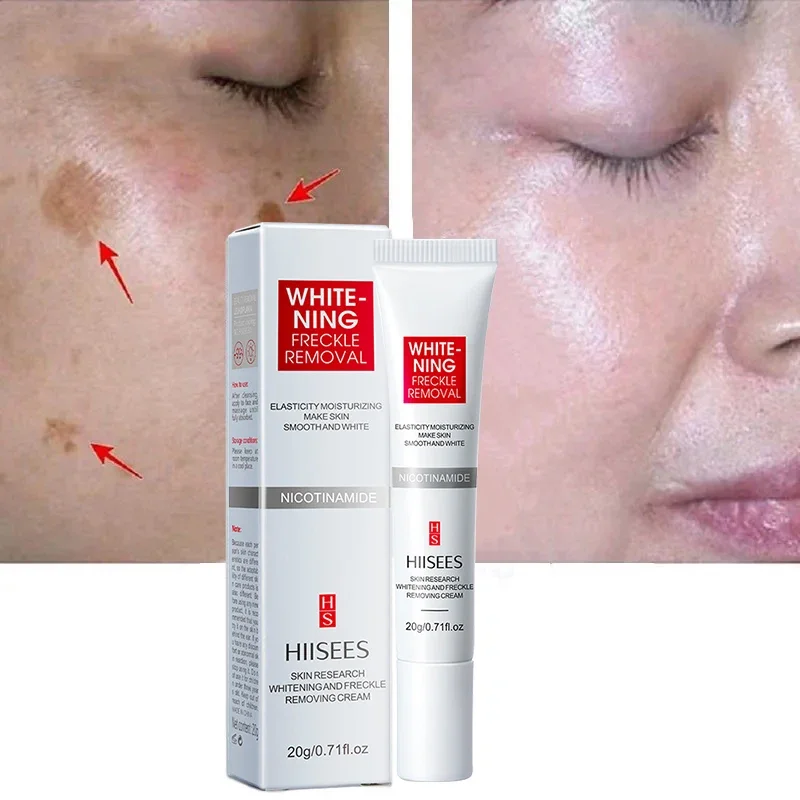 Whitening Sproet Crème Effectief Verwijderen Melasma Crème Verwijderen Donkere Vlekken Hydrateren Gladde Huidverzorging