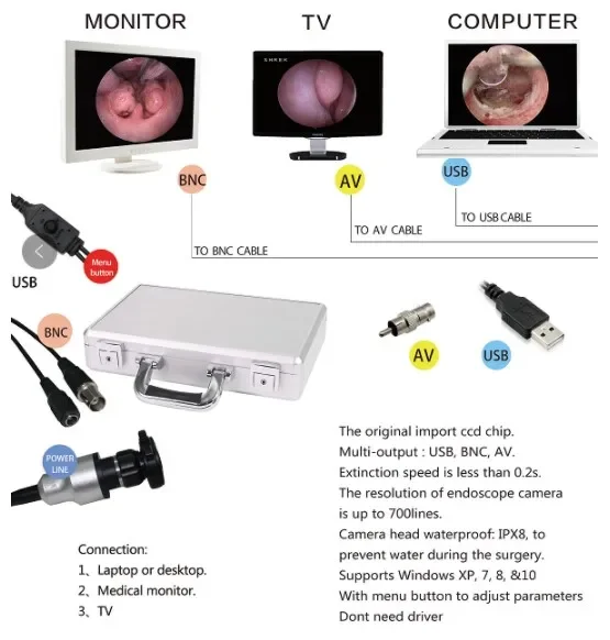 Direct Connect To PC/TV For ENT Diagnosis Portable USB Endoscope