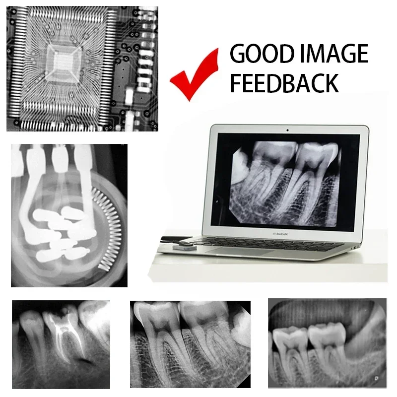 Odonto Sem Galantia เม็กซิโกสต็อก GreatLife ทันตกรรม Hyperlight X-Ray ดิจิตอลแบบพกพา X Ray Rvg Sensor เครื่องระบบ Rx กล้อง