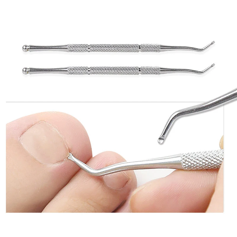 1 set di strumenti per la correzione dell'unghia del piede pedicure recuperare incorporare il trattamento delle unghie dei piedi strumento professionale per la correzione della cura del piede