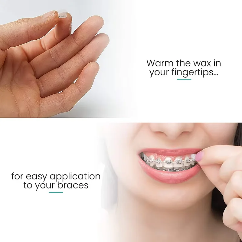 10PCS Fruit Flavour Orthodontic Relief Wax For Braces Patient Relief Protect Lips and Gums Irritation Oral Care Ortho Wax