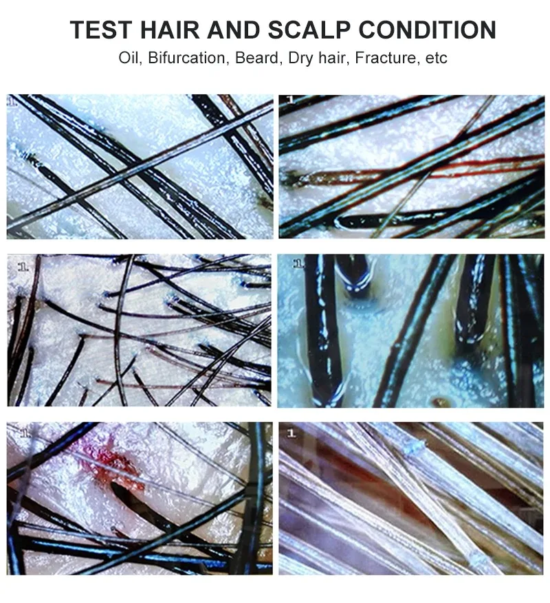 Analyseur de peau de 7 pouces, détecteur de cuir chevelu, testeur d'humidité des follicules pileux, Machine d'analyse de cheveux de la peau du visage, Rechargeable