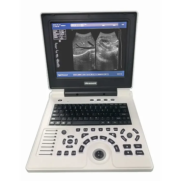 Digital Laptop Ultrasound Machine best price ultrasound Scanner