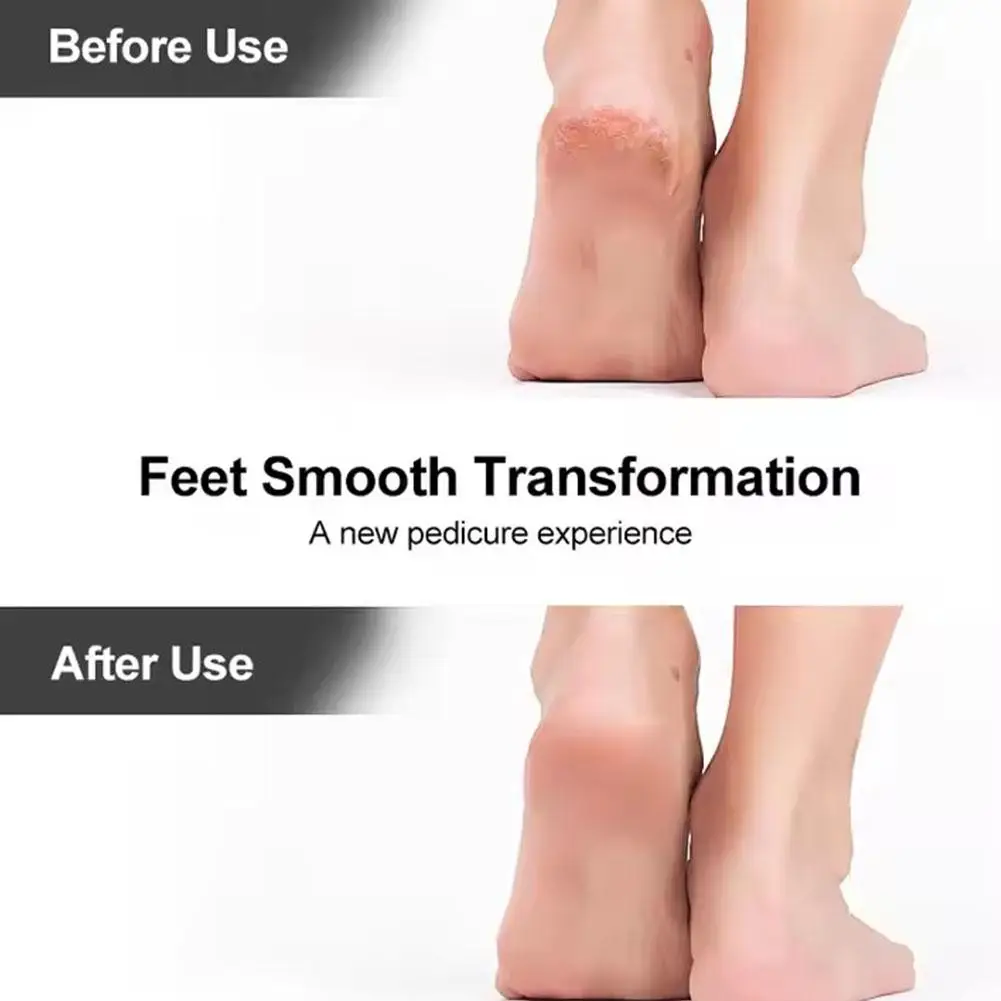 Raspador de arquivo de pé de aço profissional para remoção de calos e pele morta, ferramenta de pedicure para cuidados com os pés