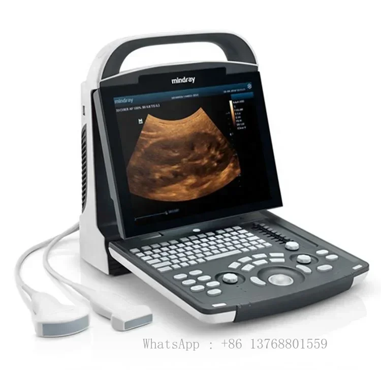 Hot sale ultrasound scanner white black mindray dp 20 mindray ultrasound machine china