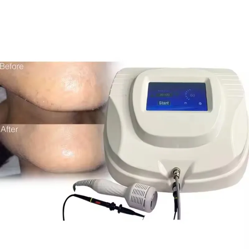 جهاز إزالة الشعر الدائم بإبرة دقيقة كهربائية من RBS لجميع ألوان جهاز إزالة الشعر بالتحليل الكهربائي