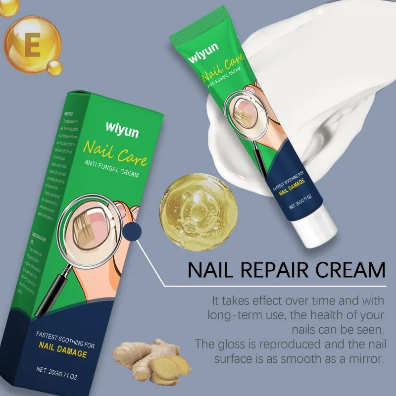 Nagel pflege Reparatur creme Anti-Infektion Onycho mykose pflegende Nagel glanz beruhigende Beschwerden feuchtigkeit spendende Pflege Reinigungs creme