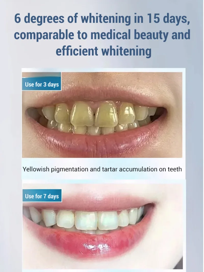 Toothpaste whitening translucent yellowing clean white stains yellowing fresh breath herbal toothpaste genuine health oral care