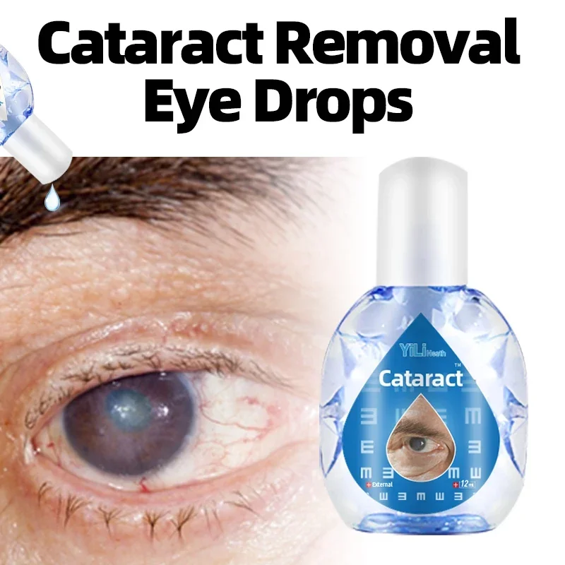 

Cataract Treatment Medicine Improve Macular Degeneration And Eye Discomfort Blurred Vision Glaucoma Removal Eye Drops 12Ml