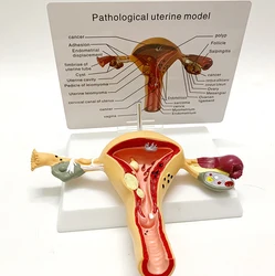 Human Model Female Reproductive Uterine Vaginal Ovarian Uterine Teaching Mold Pathology Popular Science Training Teaching Tool